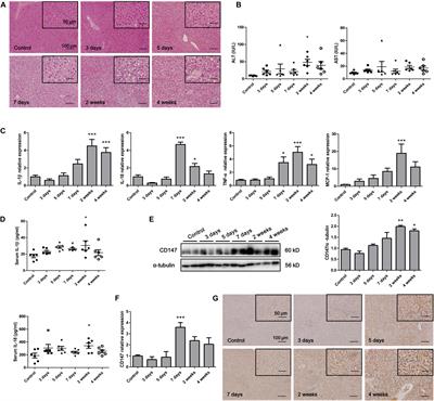 Deficiency of CD147 Attenuated Non-alcoholic Steatohepatitis Progression in an NLRP3-Dependent Manner